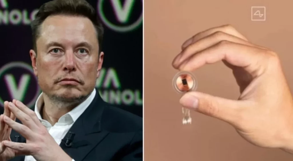 Telepathy: il primo chip cerebrale di Elon Musk che rivoluziona la tecnologia 20240201 115818