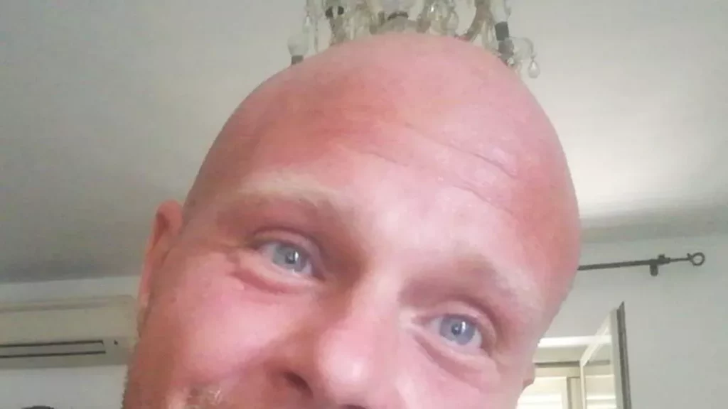 Tragedia a Manziana: Uomo sbranato da tre rottweiler mentre faceva jogging 20240211 175139