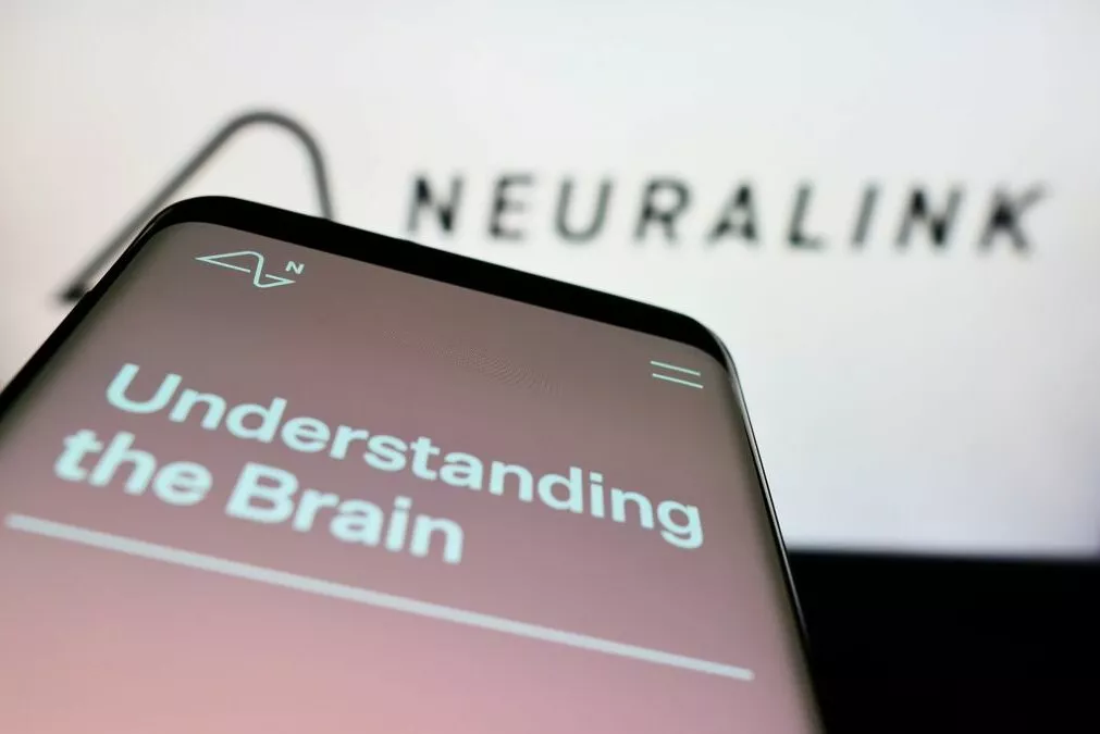 Neuralink: Critiche, Trasparenza e Implicazioni Etiche delle Neurotecnologie 20240302 034335 1